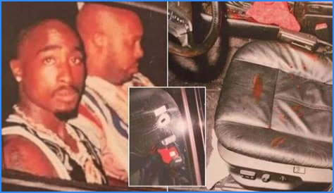 2Pac Autopsy Photo Surfaces: Leaked Images Spark New Conspiracy Theories