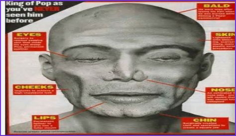 Autopsy Photos Leak: Ethics, Trauma, and the Fight for Control