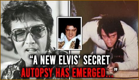 Elvis's Autopsy: Hidden Details & Lingering Questions Revealed