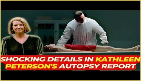 Kathleen Peterson Autopsy Photos: Public Release Sparks Debate