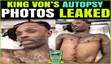 King Von Autopsy Photos: Leaked Images Spark Outrage, Investigation