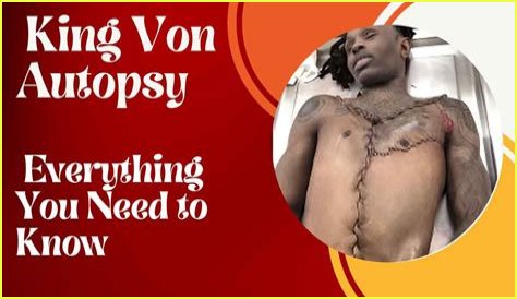 King Von Autopsy Video Leak: Ethical Line Crossed?