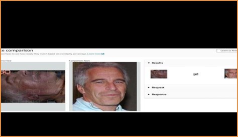 New Epstein Autopsy: Scars, Fractures Fuel Conspiracy Theories