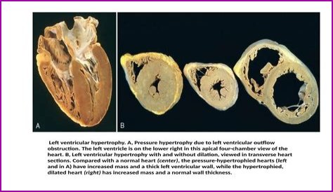 Nicholas Alexander Allen Autopsy: Heart Condition Revealed?